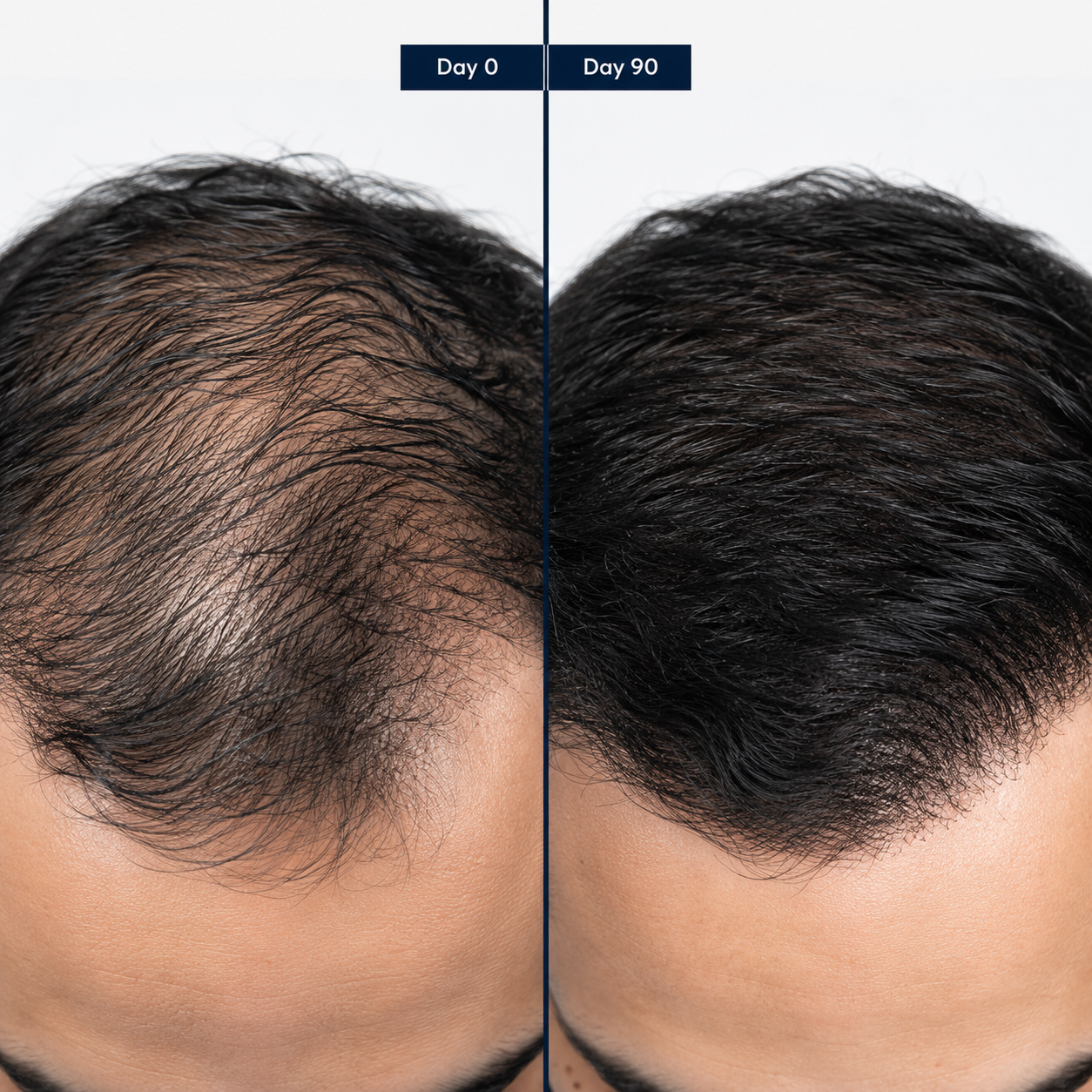 Reborn Hair serum