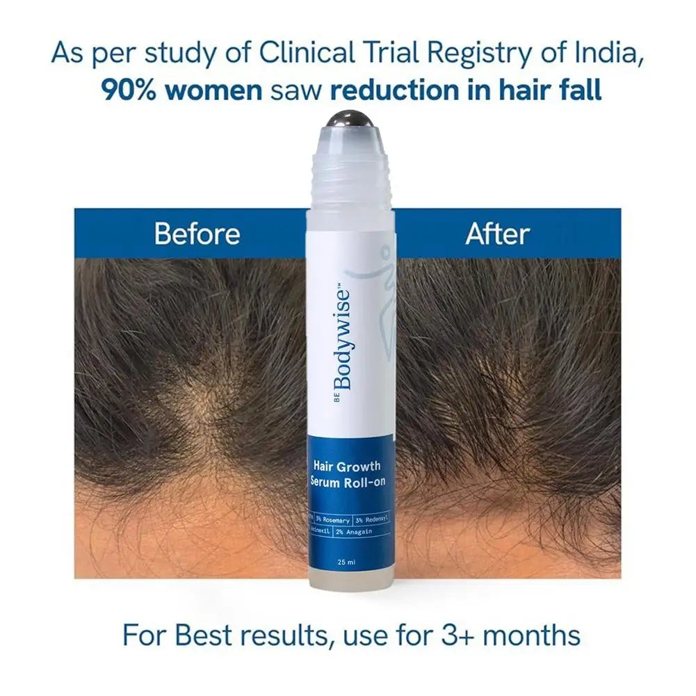 3% Rosemary Hair Growth Serum - Deep Scalp Nourishment Frizz Control Strengthen Hair Roots Hair Care Essence Oil 25ml