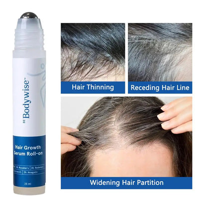 3% Rosemary Hair Growth Serum - Deep Scalp Nourishment Frizz Control Strengthen Hair Roots Hair Care Essence Oil 25ml